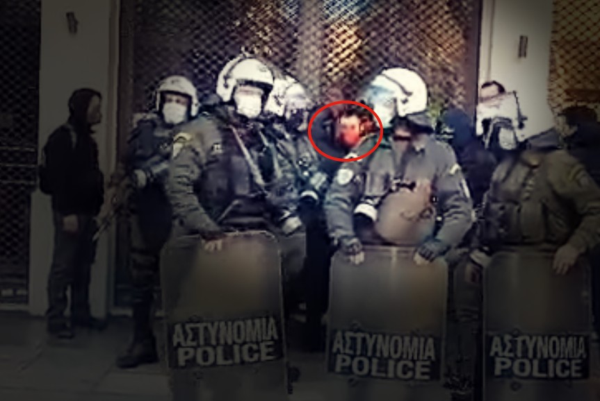 Καταγγελία: Θύμα στοχευμένης αστυνομικής επίθεσης ο δημοσιογράφος Χρήστος Αβραμίδης (video)