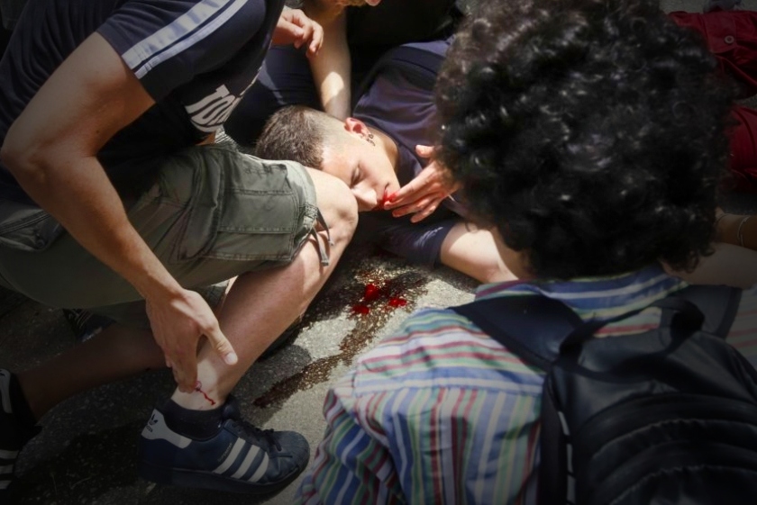 Θεσσαλονίκη: Ξανά στο νοσοκομείο με υποτροπή ο φοιτητής που τραυμάτισαν τα ΜΑΤ